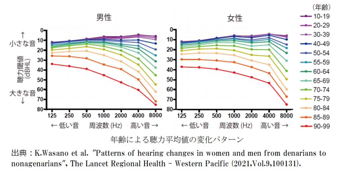 年齢による聴力平均値の変化パターン